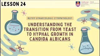 Understanding The Transition From Yeast To Hyphal Growth In Candida Albicans [upl. by Lunette]