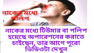 Discussion of Nasal Polypনাকের পলিপ বা টিউমারits causesDiagnosisHomeopathy treatmentManagement [upl. by Sewellyn]