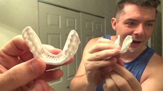 Sisu Mouthguard Molding and Review [upl. by Lundgren]