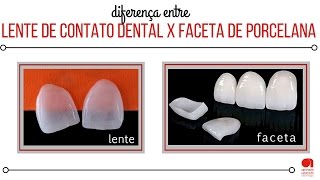 Lente de Contato Dental e Faceta de Porcelana  qual a diferença entre elas [upl. by Dlarrej171]