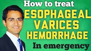 Esophageal Varices amp Variceal Hemorrhage Treatment and ManagmentSTEP WISE APPROACH [upl. by Wilcox]