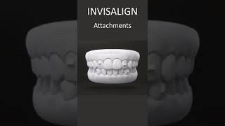 Invisalign Attachments  How They Work  London UK [upl. by Eural]