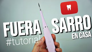 COMO QUITAR EL SARRO 💩 DE LOS DIENTES EN CASA 🏡 con este APARATO ⛏ TUTORIAL [upl. by Efthim437]