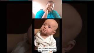 Baby Hears For The First Time hearingloss [upl. by Derfniw]