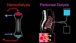 Basics of Dialysis and Modalities [upl. by Nance340]