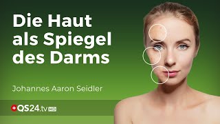 Die Haut als Spiegel des Darms  NaturMEDIZIN  QS24 Gesundheitsfernsehen [upl. by Catriona]