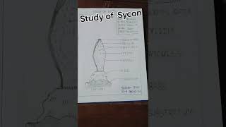 zoology practical of Sycon [upl. by Drawde875]