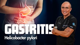 ¿Son sintomas de Gastritis o Bacteria Helicobacter Pylori [upl. by Euqininod]