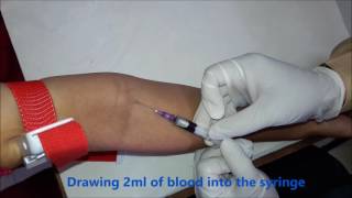 Intra Venous IV blood collection technique [upl. by Enier]