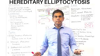 HEREDITARY ELLIPTOCYTOSIS  Quick Review  By Pramil Cheriyath MD [upl. by Lathrope]