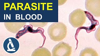 Blood Parasite That Makes You Sleepy Trypanosoma Under the Microscope [upl. by Ardnekan]