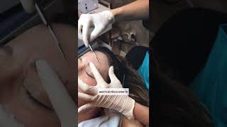 Esthetician Training Elevate your dermaplaning skills [upl. by Bekha]