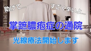 【コロナワクチン後遺症？】掌蹠膿疱症乾癬の治療。メンタル崩壊。 [upl. by Emelen5]