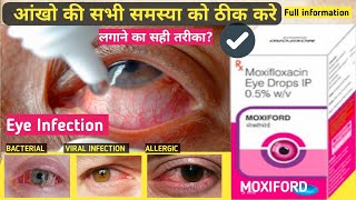 moxiford eye drop review  moxifloxacin  uses and benifits  how to use  in hindi [upl. by Amalea987]