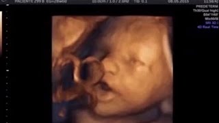 Amazing video shows 16 weeks babies SINGING in the womb Foetus can [upl. by Camroc275]