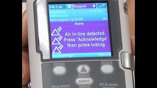 Air In line Alarms  CADD® Solis Ambulatory Infusion Pump [upl. by Warrenne]