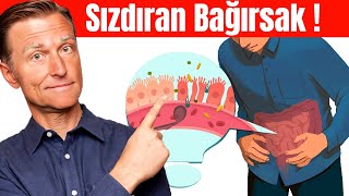 Sızdıran Bağırsakların 7 İşareti  Dr Berg Türkçe [upl. by Immot147]