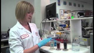 Preparing and Staining Blood Film [upl. by Marciano]