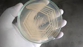 Colony characteristics of Staphylococcus aureus on nutrient agar [upl. by Gautea]