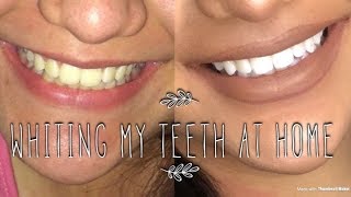 whiting my teeth at home  تبيض اسناني في المنزل [upl. by Elberfeld461]