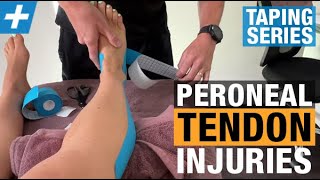 How to Tape for Peroneal Tendon Injuries [upl. by Tully845]