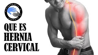 Hernia de disco cervical o hernia discal cervical que es y porque se produce [upl. by Ahsinaw]