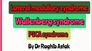 Lateral medullary syndrome Wallenberg syndrome PICA syndrome by Dr Raghib Asfak [upl. by Peterson]