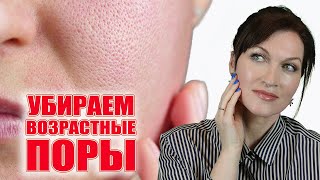 Стянем расширенные поры Причина и решения Лучшие средства [upl. by Serolod]