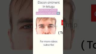 elocon ointment review in telugu  full video in relate button medicine fact [upl. by Nahtanoy]