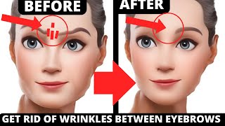 FACE YOGA FOR WRINKLES BETWEEN EYEBROWS  FACE YOGA FOR FROWN LINES [upl. by Ahpla]