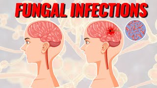 Deadly Fungal Infections Spreading [upl. by Nawyt]