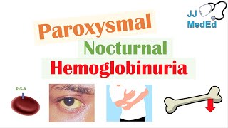 Paroxysmal Nocturnal Hemoglobinuria PNH  Causes amp Pathogenesis Symptoms Diagnosis amp Treatment [upl. by Marchelle]