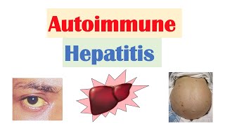 Autoimmune Hepatitis  Pathogenesis Signs amp Symptoms Diagnosis Treatment [upl. by Voletta]