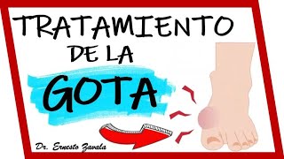 🚨📣TRATAMIENTO de la GOTA ¿Cuál es el mejor 😳 ¿Qué alimentos evitar ALOPURINOL COLCHICINA [upl. by Euf]