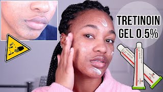 I STARTED USING TRETINOIN GELRETINA FOR MY ACNE  HERES WHAT HAPPENED ♡ OfficialTashika [upl. by Leacock287]