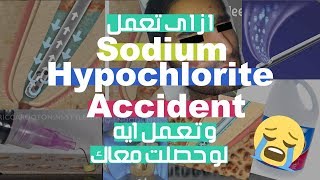 How To Avoid and How To Manage Sodium Hypochlorite Accident [upl. by Anairb]