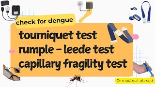 Tourniquet test  Capillary Fragility Test  RumpelLeede Test  Petechia  simple explanation [upl. by Rozele770]