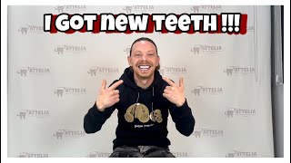 I GOT NEW TEETH  TEETH DOCUMENTARY PT 2  FINAL TEETH [upl. by Annaehr301]