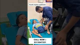 Cauda equina syndrome  Chiropractic Treatment in Mumbai  Dr Varun  Call  9313047251 mumbai [upl. by Srednas]