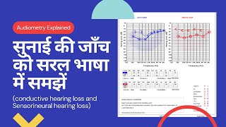 Hearing test explained  सुनाई की जाँच ।Deafness test in Hindi  Pure tone Audiometry interpretation [upl. by O'Donoghue]