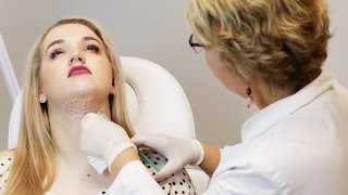 Kybella Injection For Nonsurgical Double Chin Treatment [upl. by Koziara483]