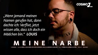 Louis ist transgender – die Narben kommen von seiner Geschlechtsangleichung  Meine Narbe  COSMO [upl. by Comfort142]