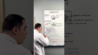 Ischemic Stroke  Lacunar Infarct shorts [upl. by Aline]