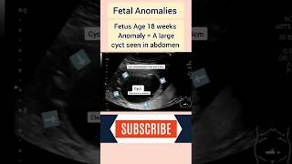 Fetal anomaly ultrasound scan pregnancyultrasound medical pregnant baby [upl. by Reube]