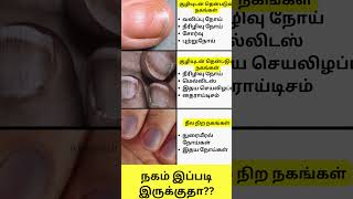 நகம் இப்படி இருக்குதா Nail Disorders in Tamil Shorts intamizh [upl. by Seale422]