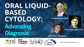 Oral LiquidBased Cytology Advancing Diagnosis in Developing Nations [upl. by Aeslek361]