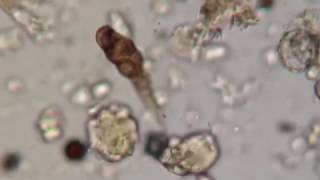 Looking at Soil Microbes with a Compound Microscope [upl. by Tongue180]