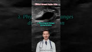 Breast Duct Dilatation Differential Diagnoses radiology [upl. by Paryavi929]