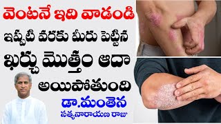 95 Big Result  Psoriasis amp Vitiligo Best Foods  Dr Manthena Satyanarayana Raju  HEALTH MANTRA [upl. by Druce]