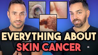 Everything About Skin Cancer Prevent Identify Biopsy and Treatment  Dermatologist Explains [upl. by Nivrem]